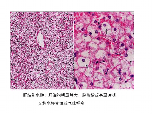 病理图片描述47张