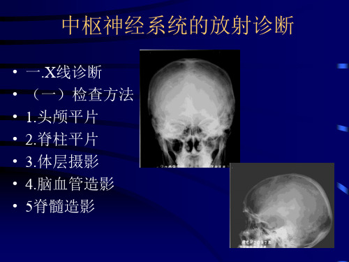 影像诊断神经系统精品PPT课件