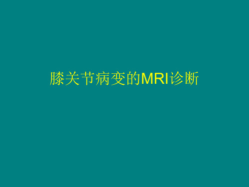 膝关节病变的MR诊断(2)