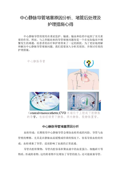 中心静脉导管堵塞原因分析、堵管后处理及护理措施心得