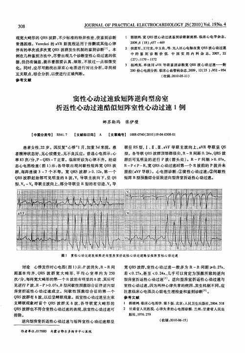 窦性心动过速致短阵逆向型房室折返性心动过速酷似短阵室性心动过速1例