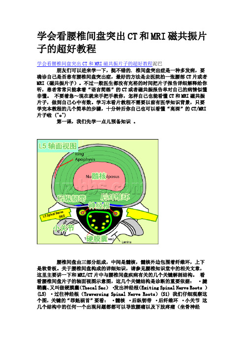 如何看颈腰椎(图)