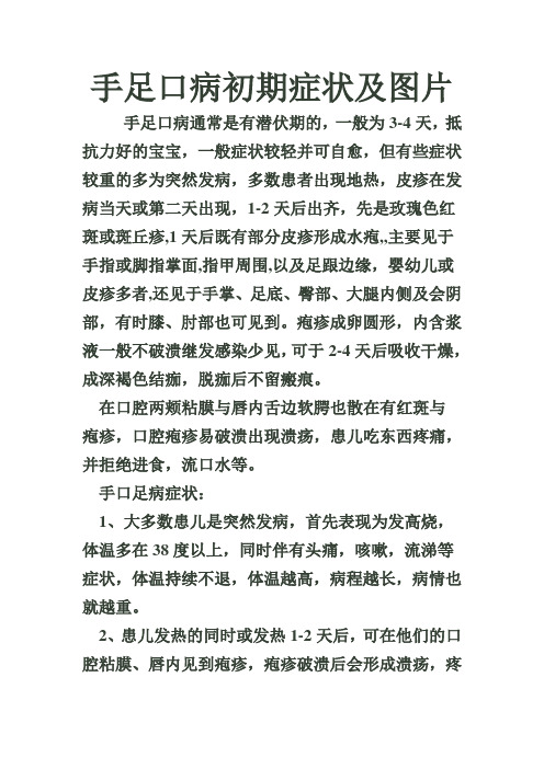 手足口病症状,预防方法及图片