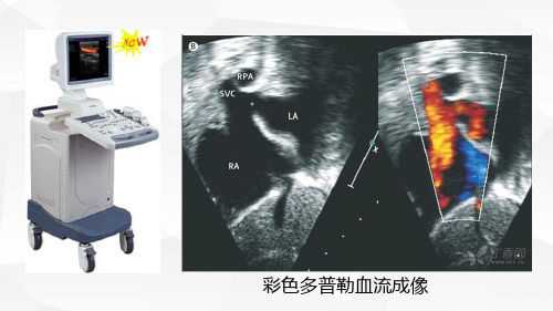 19 第八章 第五节 彩色多普勒血流成像