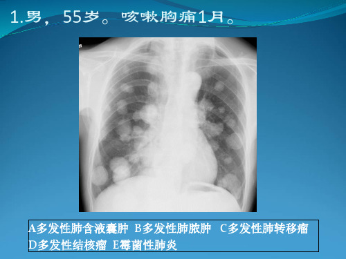 放射科住院医生规范化培训考试题