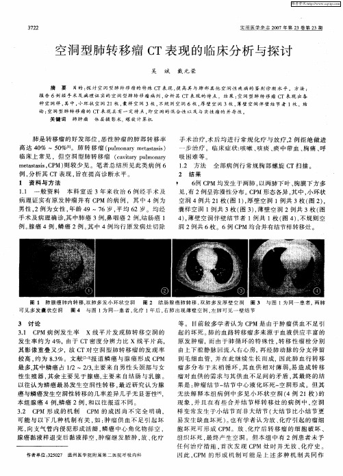 空洞型肺转移瘤CT表现的临床分析与探讨