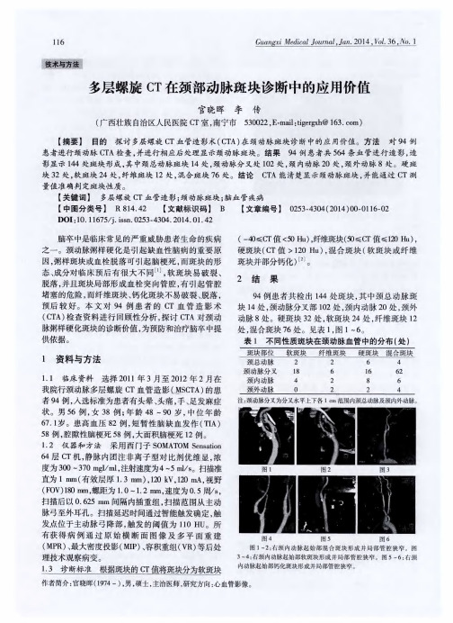 多层螺旋CT在颈部动脉斑块诊断中的应用价值