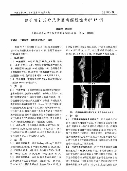 缝合锚钉治疗尺骨鹰嘴撕脱性骨折15例