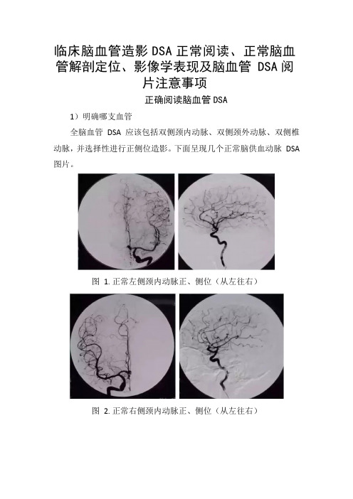 脑血管造影DSA正常阅读、正常脑血管解剖定位、影像学表现及脑血管-DSA阅片注意事项