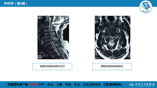 第六十七章 颈、腰椎退行性疾病 第一节 颈椎退行性疾病_2