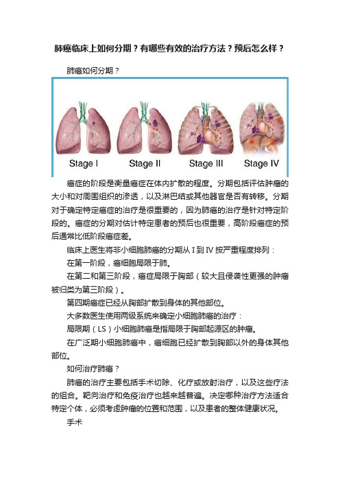 肺癌临床上如何分期？有哪些有效的治疗方法？预后怎么样？