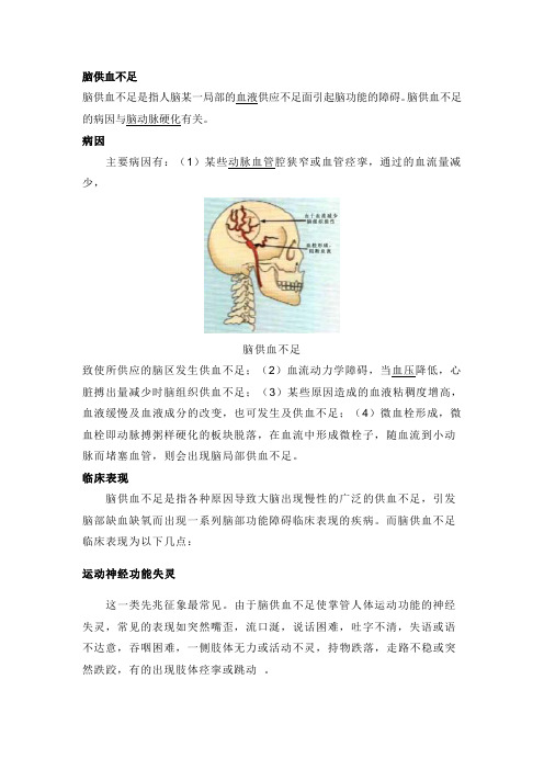 心脑供血不足疗法