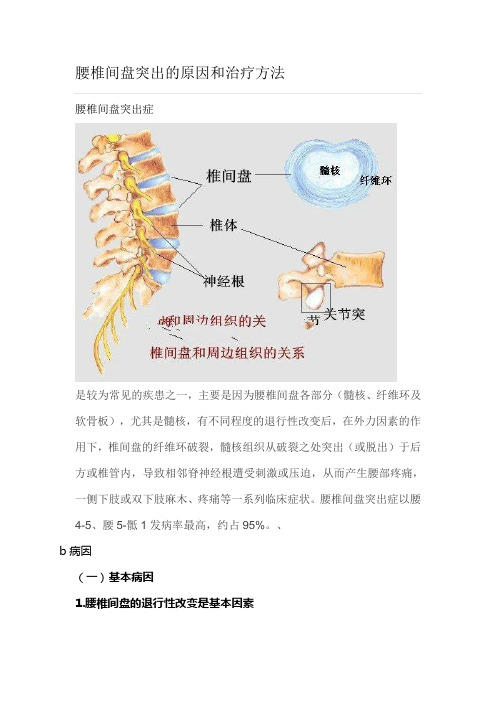 腰椎间盘突出原因和治疗方法