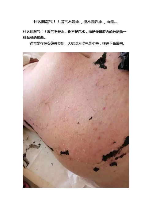 什么叫湿气！！湿气不是水，也不是汽水，而是....