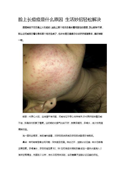 脸上长痘痘是什么原因 生活妙招轻松解决