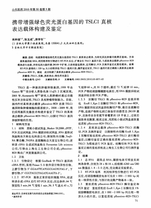 携带增强绿色荧光蛋白基因的TSLC1真核表达载体构建及鉴定