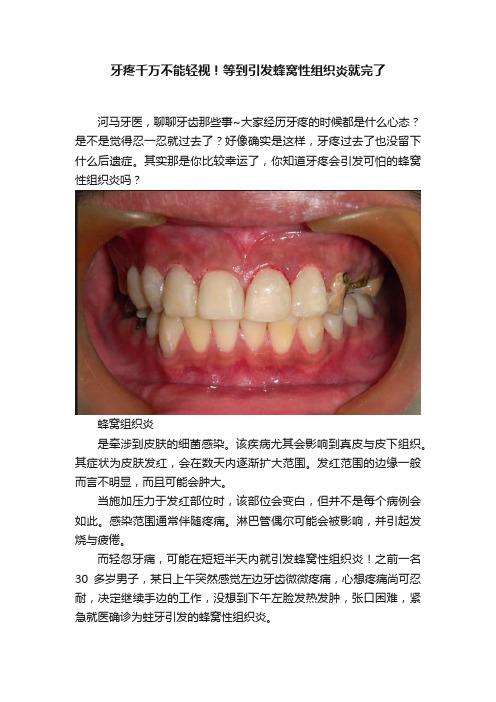 牙疼千万不能轻视！等到引发蜂窝性组织炎就完了