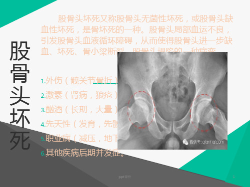 股骨头坏死  ppt课件