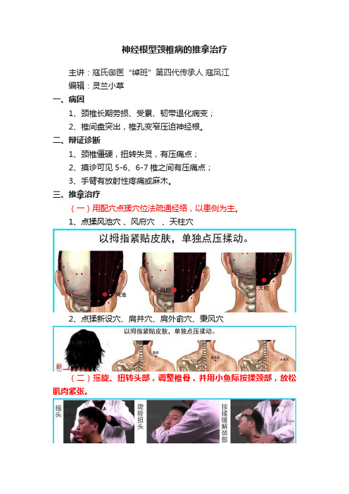 神经根型颈椎病的推拿治疗