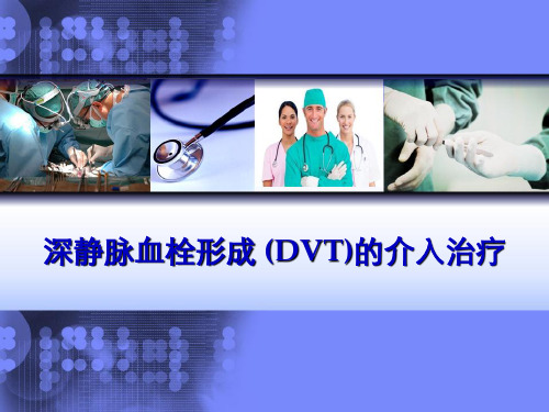 深静脉血栓形成 (DVT)的介入治疗 PPT