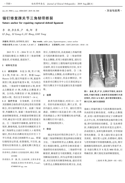 锚钉修复踝关节三角韧带断裂