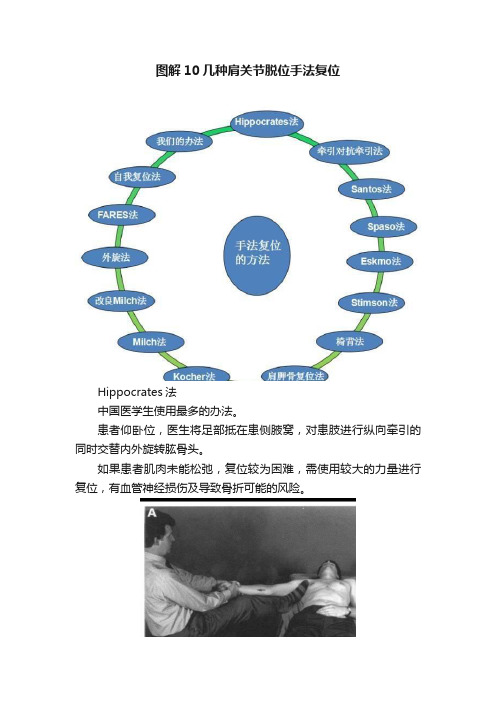 图解10几种肩关节脱位手法复位