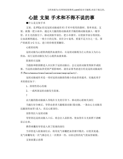 心脏支架手术和不得不说的事