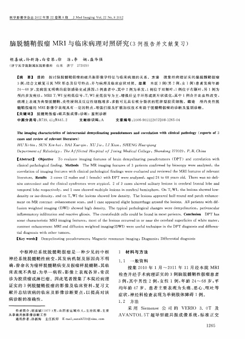 脑脱髓鞘假瘤MRI与临床病理对照研究(3例报告并文献复习)