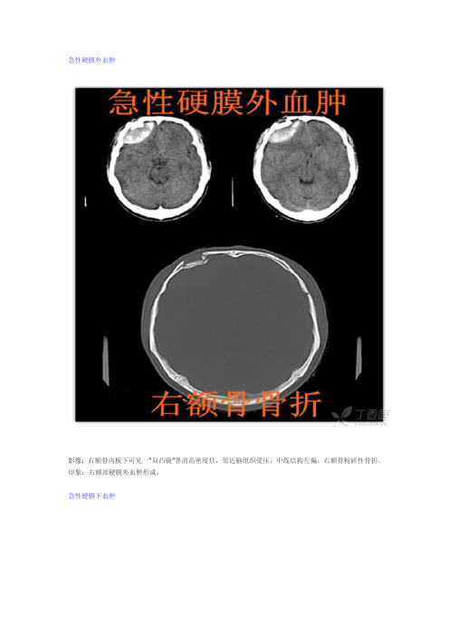 颅脑CT