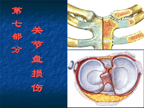 第七部分   关节盘(板)损伤