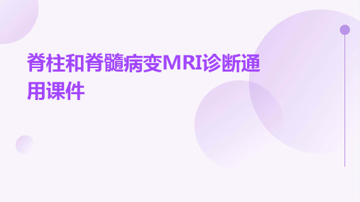 脊柱和脊髓病变MRI诊断通用课件