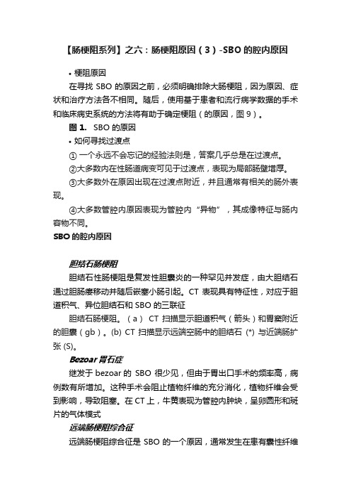 【肠梗阻系列】之六：肠梗阻原因（3）-SBO的腔内原因