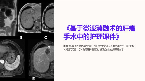 《基于微波消融术的肝癌手术中的护理课件》