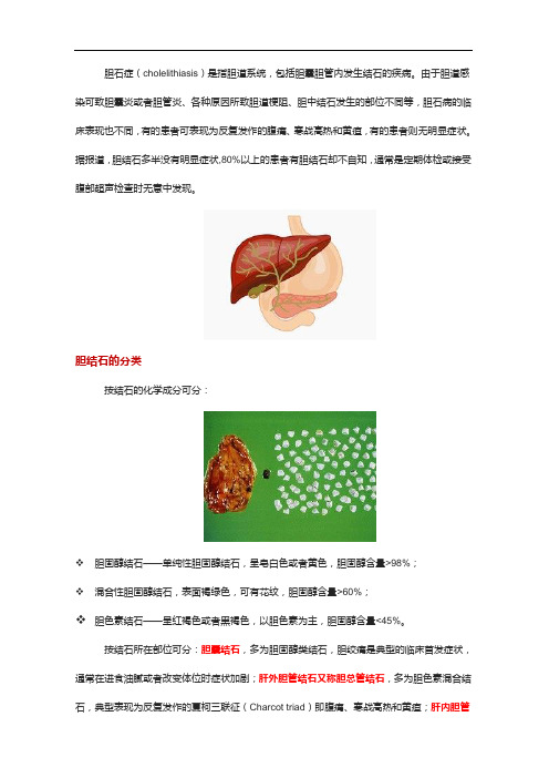 胆石症胆囊结石的详细分类及治疗原则