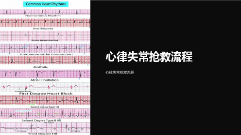心律失常抢救流程