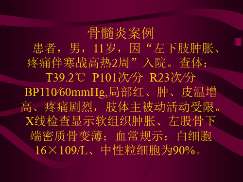 骨髓炎案例.ppt