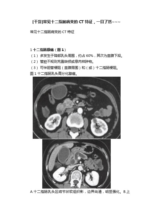 [干货]常见十二指肠病变的CT特征，一目了然~~~