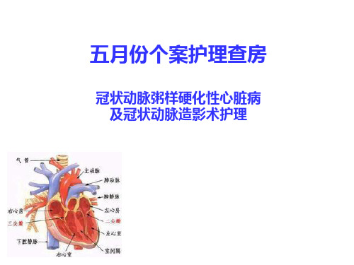 冠心病及造影术后个案护理查房