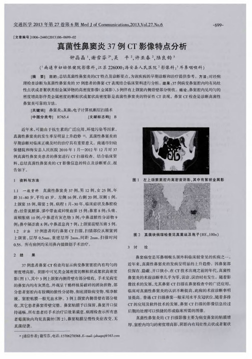 真菌性鼻窦炎37例CT影像特点分析真菌性鼻窦炎37例CT影像特点分析