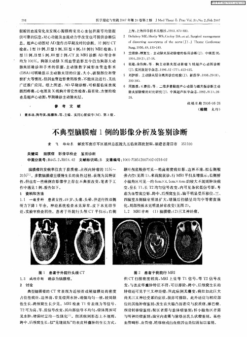 不典型脑膜瘤1例的影像分析及鉴别诊断