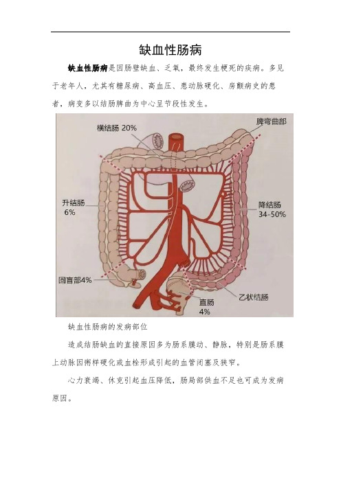 缺血性肠病