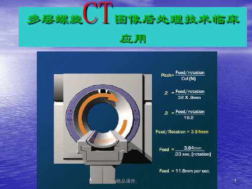 CT图像后处理技术演示课件.ppt