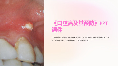 《口腔癌及其预防》课件