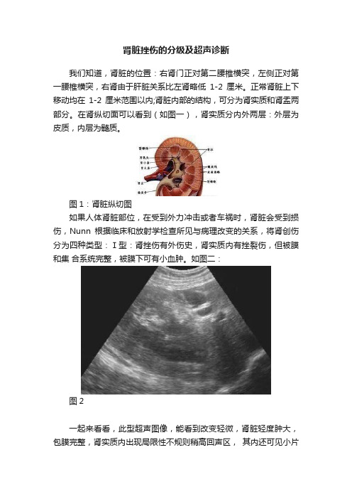 肾脏挫伤的分级及超声诊断