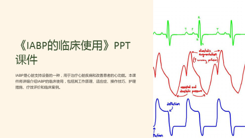 《IABP的临床使用》课件