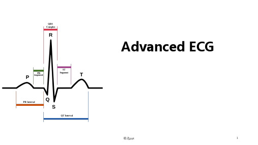 起搏器心电图ppt课件