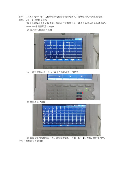 心电图机远程传输使用说明