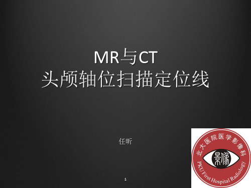 头颅定位线(MR、CT)