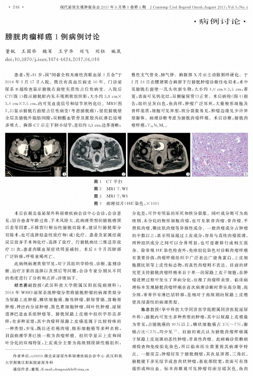 膀胱肉瘤样癌1例病例讨论