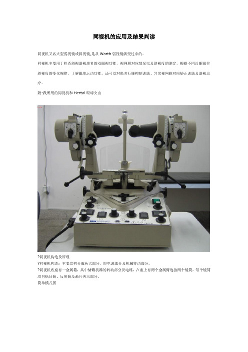 同视机的应用及结果诊断